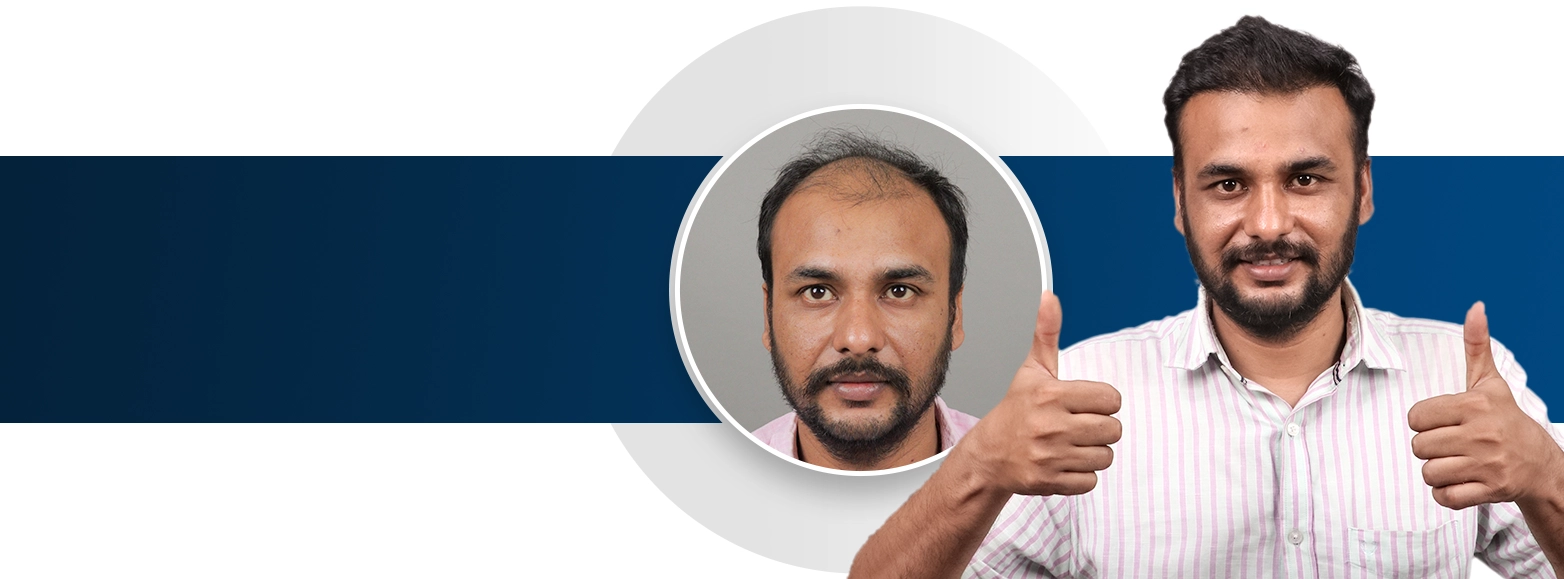 #1 Hair Clinic in Pune Kharadi